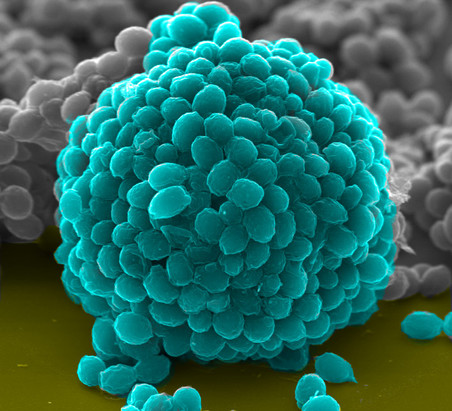 Цитозомы – трехмерные структуры, полученные из наномодифицированных клеток дрожжей